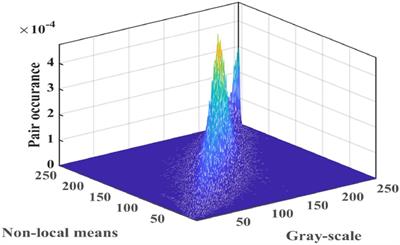 Multi-threshold image segmentation for melanoma based on Kapur’s entropy using enhanced ant colony optimization